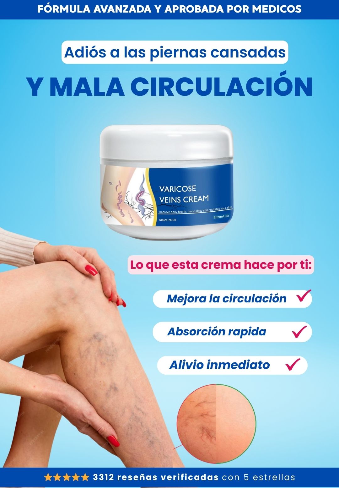 VARICOSE VEINS CREAM - Hidrata, Nutre y Cuida tus piernas todos los días