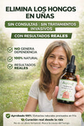 Aureva Fungivex Oil – El aceite natural que elimina los hongos desde la raíz