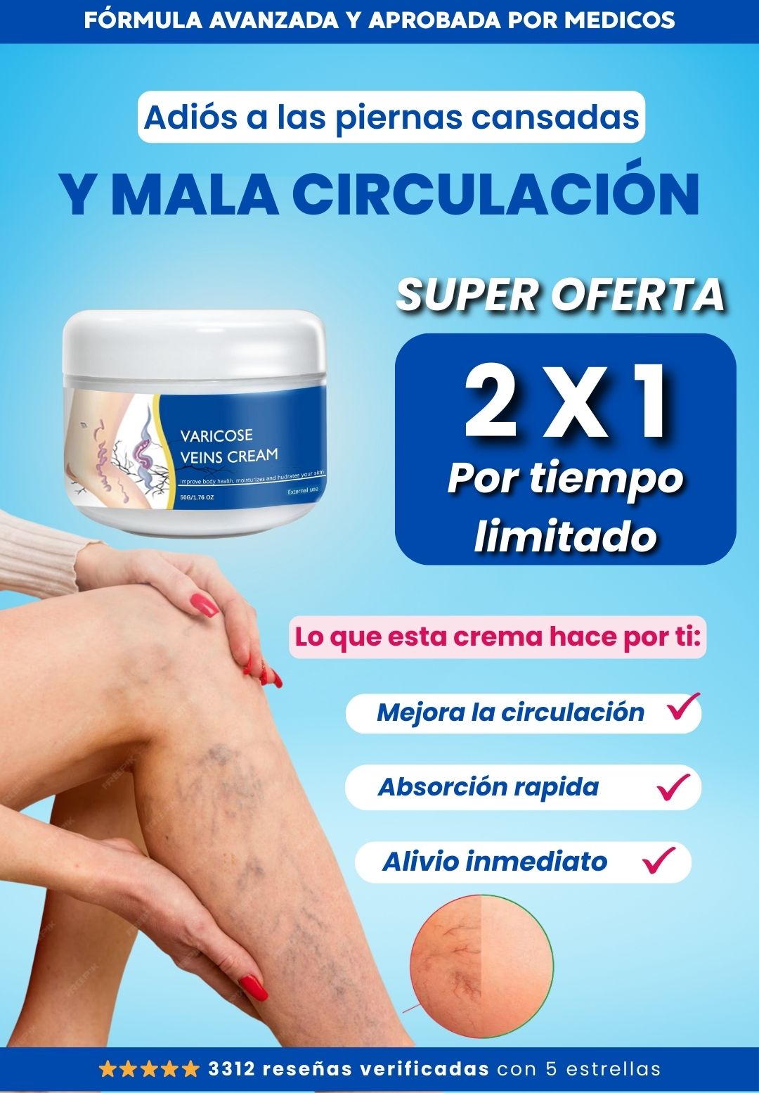 VARICOSE VEINS CREAM - Hidrata, Nutre y Cuida tus piernas 2x1
